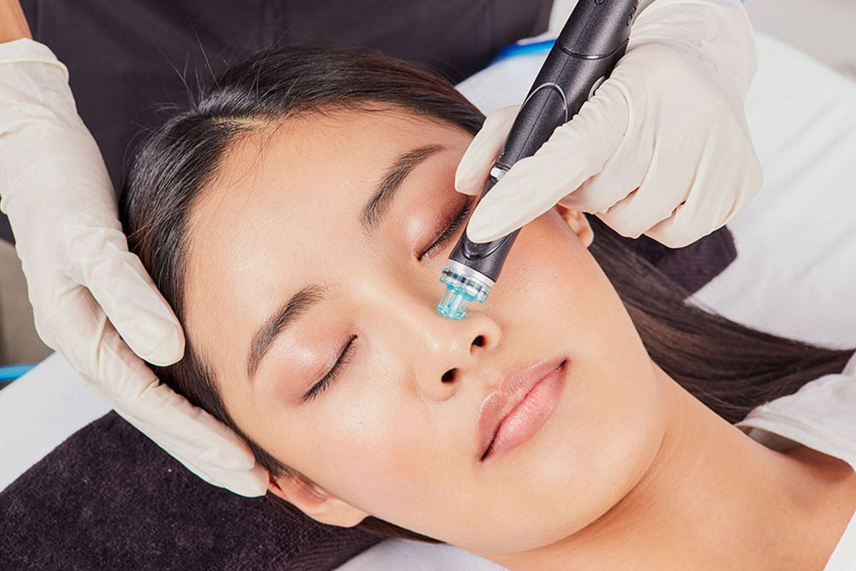 Chemical Peels Danville, CA  Indulgence Cosmetics Skin Care Clinic